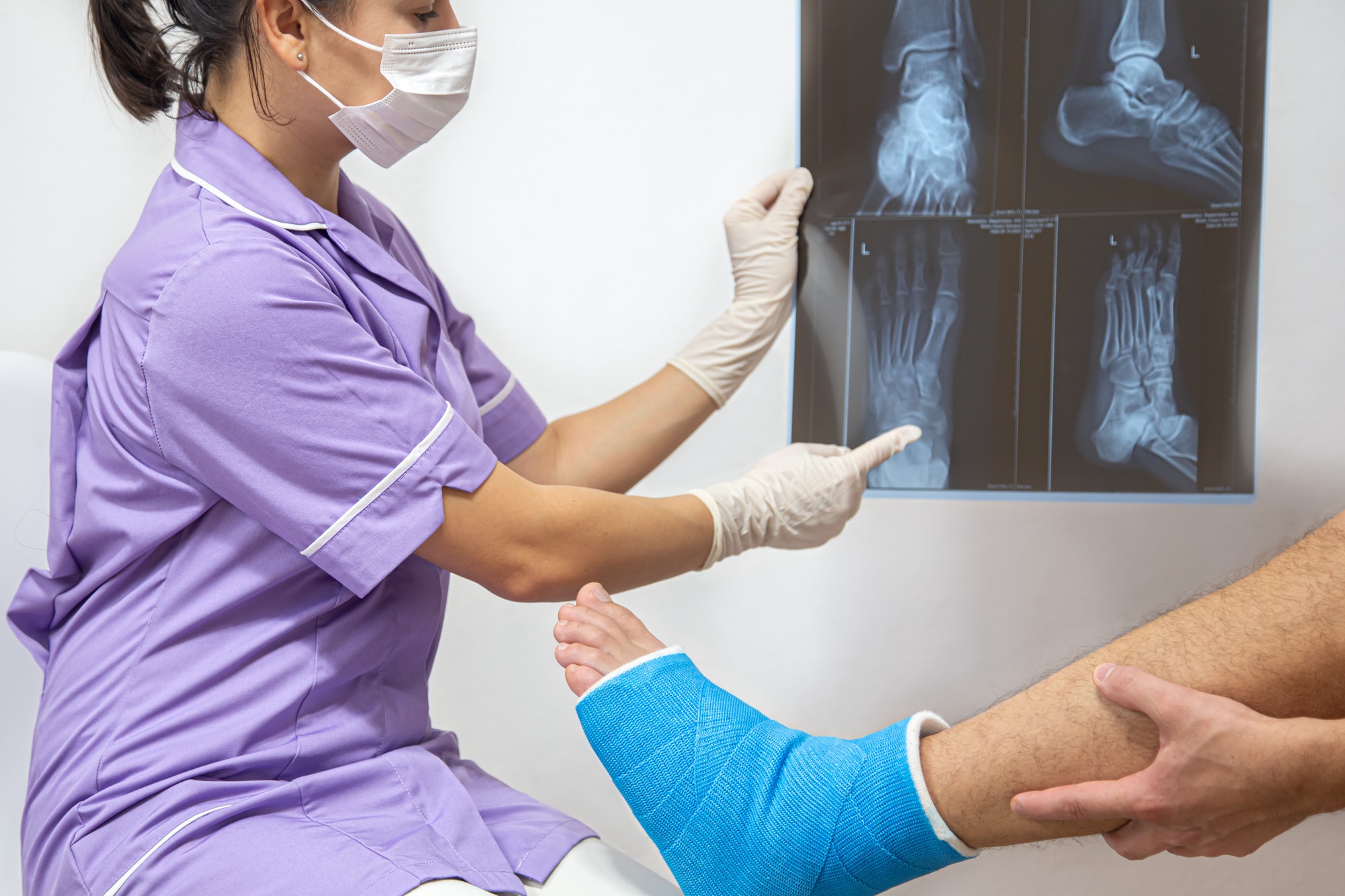 Bone fracture foot and leg on male patient being examined by a woman doctor in a hospital.